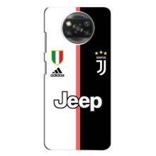 Чехлы с ТОП Футбольными клубами на Xiaomi Poco X3 Pro (Juventus)