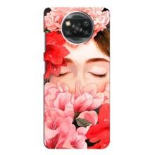 Чехлы (ART) Цветы на Xiaomi POCO X3 (VPrint) (Глаза в цветах)