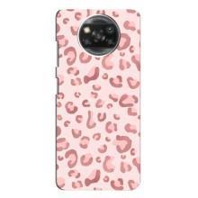 Чехол с розовым рисунком для Xiaomi POCO X3 – Розовый леопард