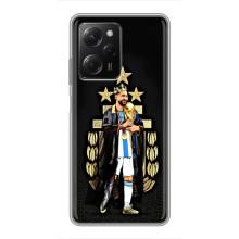 Чохли для Xiaomi POCO X5 Pro (5G) (Leo чемпіон) (AlphaPrint) (Мессі Король)