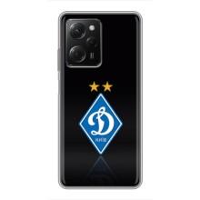 Чохли для Xiaomi POCO X5 Pro (5G) (VPrint) - Футбольні клуби (Динамо Київ)