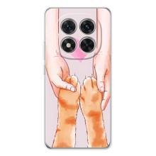 Чехол на Поко Х7 с Котами (VPrint) (Любовь к котикам)