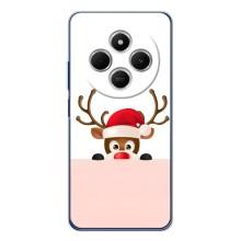 Чехол Санта Клаус для Xiaomi Redmi 14C – Олененок