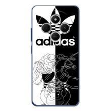 Чехол в стиле "Адидас" для Редми 15 – Adidas шнурки