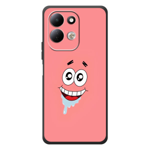 Чехлы с Патриком на Xiaomi Redmi 17 (Мордочка Патрика)