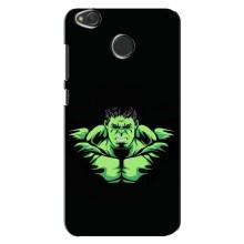 Чехлы с героями Марвел Xiaomi Redmi 4X (VPrint)
