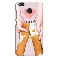 Чехол (ТПУ) Милые собачки для Xiaomi Redmi 4X – Любовь к собакам