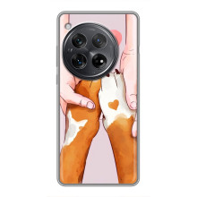 Чохли з собаками для Xiaomi Redmi K80 (VPrint) – Любовь до собак