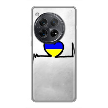 Силіконовий Чохол  на Xiaomi Redmi K80 (Я-Україна) (Українська кардіограма)