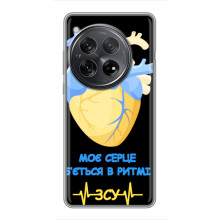 ЗСУ Чехлы (TPU) для Xiaomi Redmi K80 (Ритм ЗСУ)