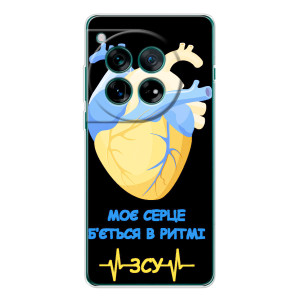 ЗСУ Чехлы (TPU) для Xiaomi Redmi K90 Pro Max