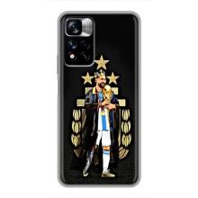 Чехлы для Xiaomi Redmi Note 11 Pro Plus (Leo чемпион) (AlphaPrint) (Месси Король)