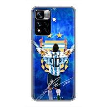 Чехлы для Xiaomi Redmi Note 11 Pro Plus (Leo чемпион) (AlphaPrint) (Месси сборная)