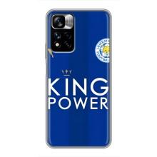 Чехлы для Xiaomi Redmi Note 11 Pro Plus (VPrint) - Футбольные клубы (Lester)
