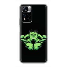 Чохли з героями Марвел Xiaomi Redmi Note 11 Pro Plus (VPrint)