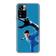 Чехол с принтом Фантастическая четверка для Xiaomi Redmi Note 11 Pro Plus – Мистер Фантастик