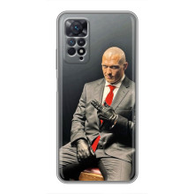 Чехол с картинкой Александр Усик для Xiaomi Redmi Note 11 Pro – Усик (Хитман)