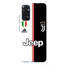 Чехлы с ТОП Футбольными клубами на Xiaomi Redmi Note 11 4G / 11s – Juventus