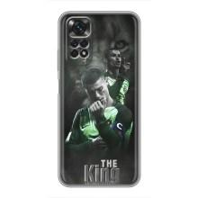 Чехол Криштиану Роналду для Xiaomi Redmi Note 11 / 11s (AlphaPrint) (Криштиано Лев)