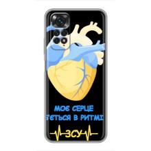 ЗСУ Чехлы (TPU) для Xiaomi Redmi Note 11 / 11s (Ритм ЗСУ)