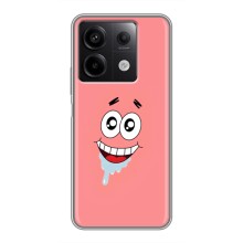 Чохли з Патріком на Xiaomi Redmi Note 13 (5G) (Мордочка Патріка)