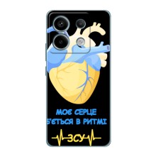 ЗСУ Чехлы (TPU) для Xiaomi Redmi Note 13 Pro (4G) – Ритм ЗСУ