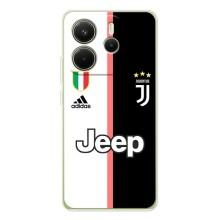 Чохли для Xiaomi Redmi Note 14 4G (VPrint) - Футбольні клуби (Juventus)
