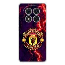 Чохол Манчестер Юнайтед для Редмі Нот 14 Про Плюс (AlphaPrint) (вогняний Манчестер)