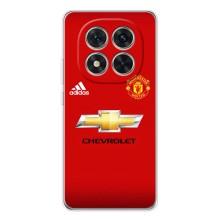 Силиконовые Чехлы принт Футбол на Xiaomi Redmi Note 14 Pro Plus – Man United
