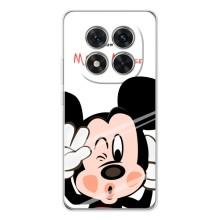 Эксклюзивный чехол для Xiaomi Redmi Note 14 Pro (AlphaPrint - Мультяшные) (Маус Микки)