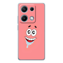 Чехлы с Патриком на Xiaomi Redmi Note 14S (Мордочка Патрика)
