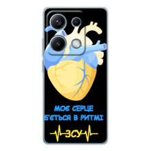 ЗСУ Чохли (TPU) для Xiaomi Redmi Note 14S (Ритм ЗСУ)