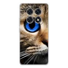 Чохли з Котиками для Xiaomi Redmi Note 15 5G (VPrint) (Око кота)