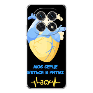 ЗСУ Чохли (TPU) для Xiaomi Redmi Note 15 5G – Ритм ЗСУ