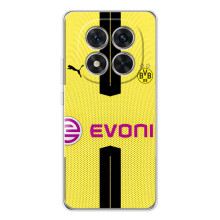 Чохли для Xiaomi Redmi Note 15 Pro 5G (VPrint) - Футбольні клуби (BVB)