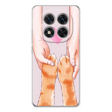 Чохол на Шiaomi Рєдмі Ноут 15 Про 5G з Котиками (VPrint) (Любовь до котиків)