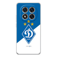 Чехол с ФК Динамо Киев на 삶ши РЭДМИ Нот 15 Про 5G (ФК Динамо Киев)