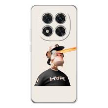 Чехлы с Обезьянами NFT для Xiaomi Redmi Note 15 Pro Plus (AlphaPrint) (обезьяна NFT в очках)