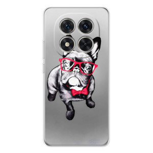 Чехол (ТПУ) Милые собачки для Xiaomi Redmi Note 15 Pro Plus – Бульдог в очках