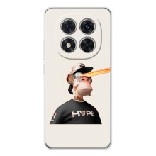 Чехлы с Обезьянами NFT для Xiaomi Redmi Note 15 Pro (AlphaPrint) (обезьяна NFT в очках)