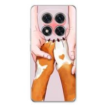Чехлы с собаками для Xiaomi Redmi Note 15 Pro (VPrint) (Любовь к собакам)