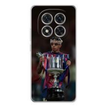 Чехол с футболистом Ламин Ямаль Xiaomi Redmi Note 15 Pro – Ямал с кубком