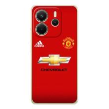 Силиконовые Чехлы принт Футбол на Xiaomi Redmi Note 15 – Man United