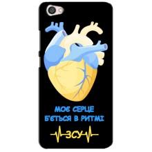 ЗСУ Чохли (TPU) для Xiaomi Redmi Note 5A (Ритм ЗСУ)