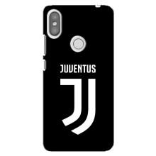 Чохли для Xiaomi Redmi S2 (VPrint) - Футбольні клуби (ФК Ювентус)