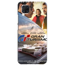 Чехол Gran Turismo / Гран Туризмо на ЗТЕ Аксон 11 (Gran Turismo)