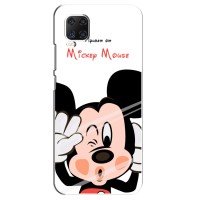 Чохли для телефонів ZTE Axon 11 - Дісней – Mickey Mouse
