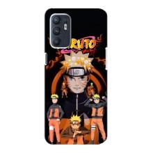 Naruto Anime Чехлы для ЗТЕ Блейд А31 Плюс (AlphaPrint)