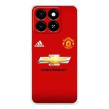 Силиконовые Чехлы принт Футбол на ZTE Blade A35 – Man United