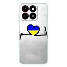 Силиконовый Чехол на ZTE Blade A35 (Я-Украина) – Украинская кардиограмма